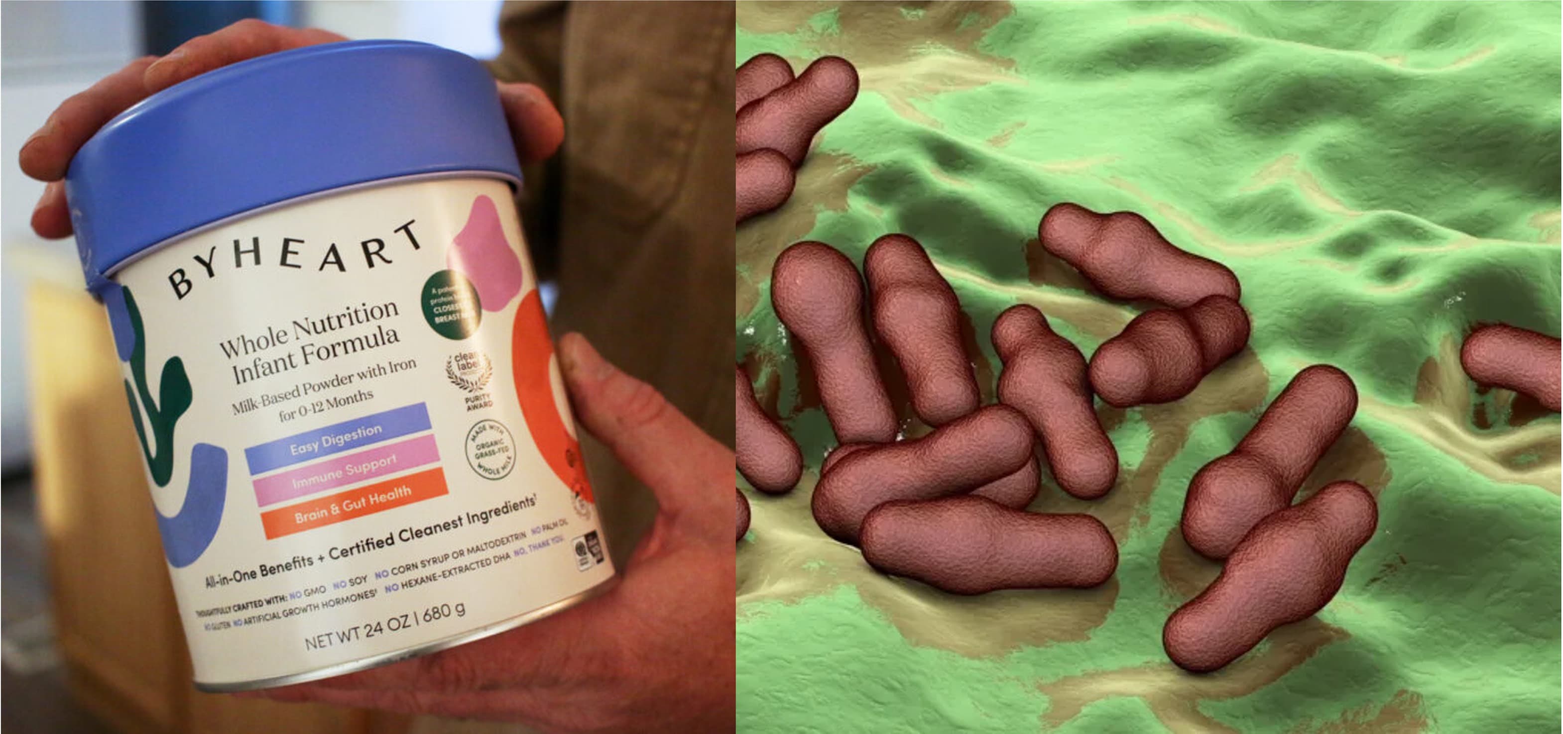 Powdered Whole Milk Under Scrutiny in Infant Botulism Outbreak