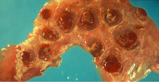 Brucellosis is a new threat to health in China