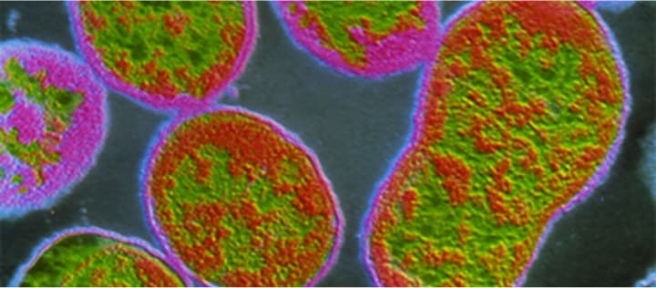 Dairy farmer, father test positive for brucellosis in Kerala’s