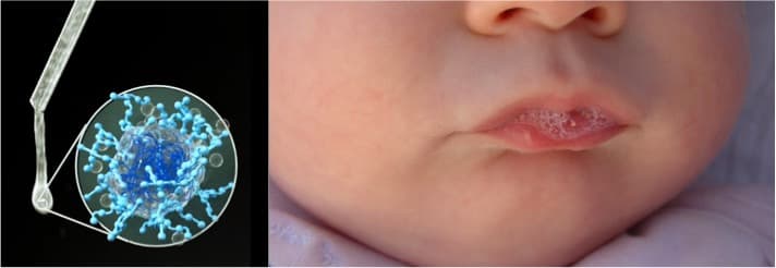 Dairy protein for long lasting relief from dry mouth conditions